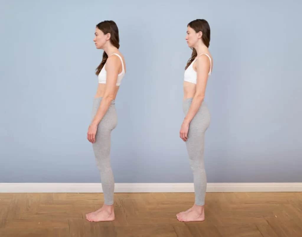 Plecy okrągłe: przyczyny, objawy i skuteczne metody leczenia